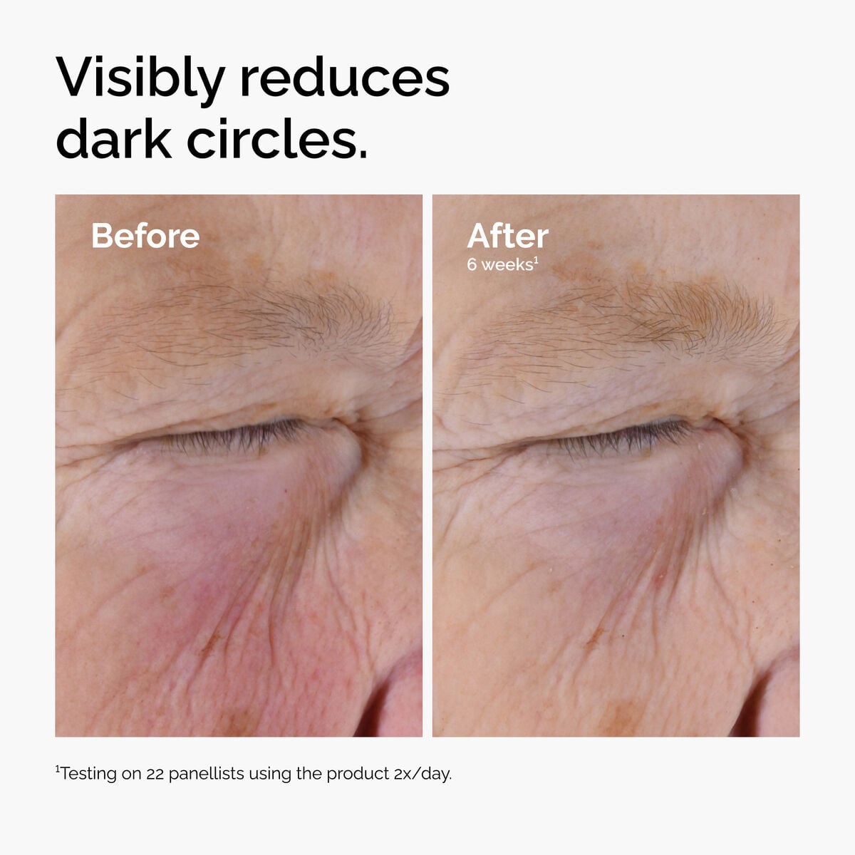 caffeine-solution-5-egcg-eye-serum-o8 ord-caffeine-solution-egcg-dark-circles-before-after.jpg