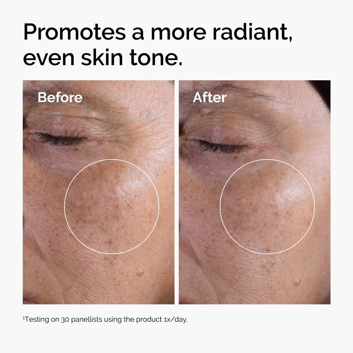 glycolic-acid-7-exfoliating-toner-b4 ord-glycolic-before-after-radiance.jpg