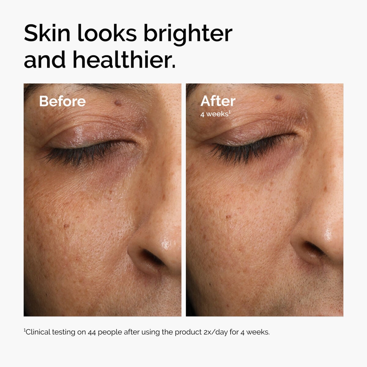 multi-antioxidant-radiance-serum-j2 ord-mars-before-after-healthy.jpg