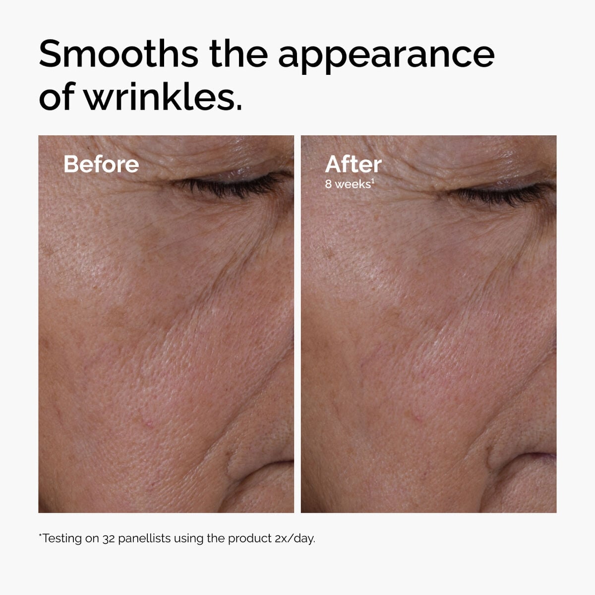 multi-peptide-ha-serum-u3 ord-multi-peptide-ha-serum-wrinkles-before-after.jpg