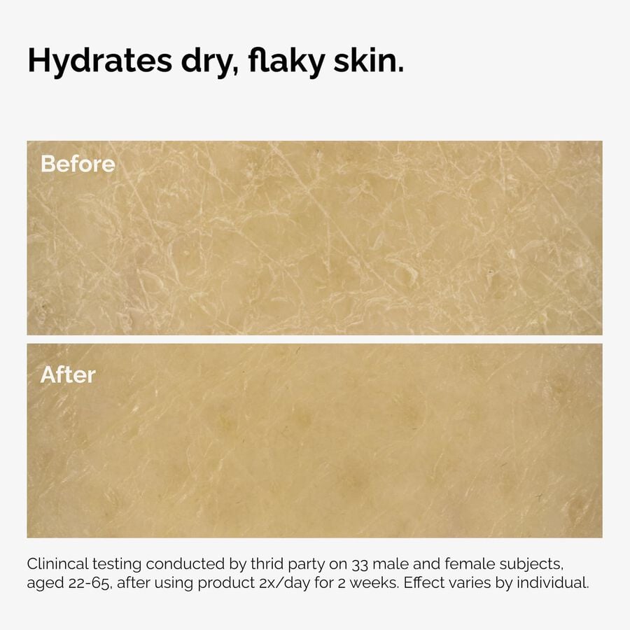 the-body-care-collection-w5 ord-natural-moisturizing-factors-inulin-body-before-after-graphic-02.jpg
