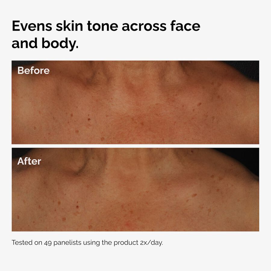 the-body-care-collection-w5 ord-niacinamide-face-body-serum-before-after-even-tone-graphic.jpg