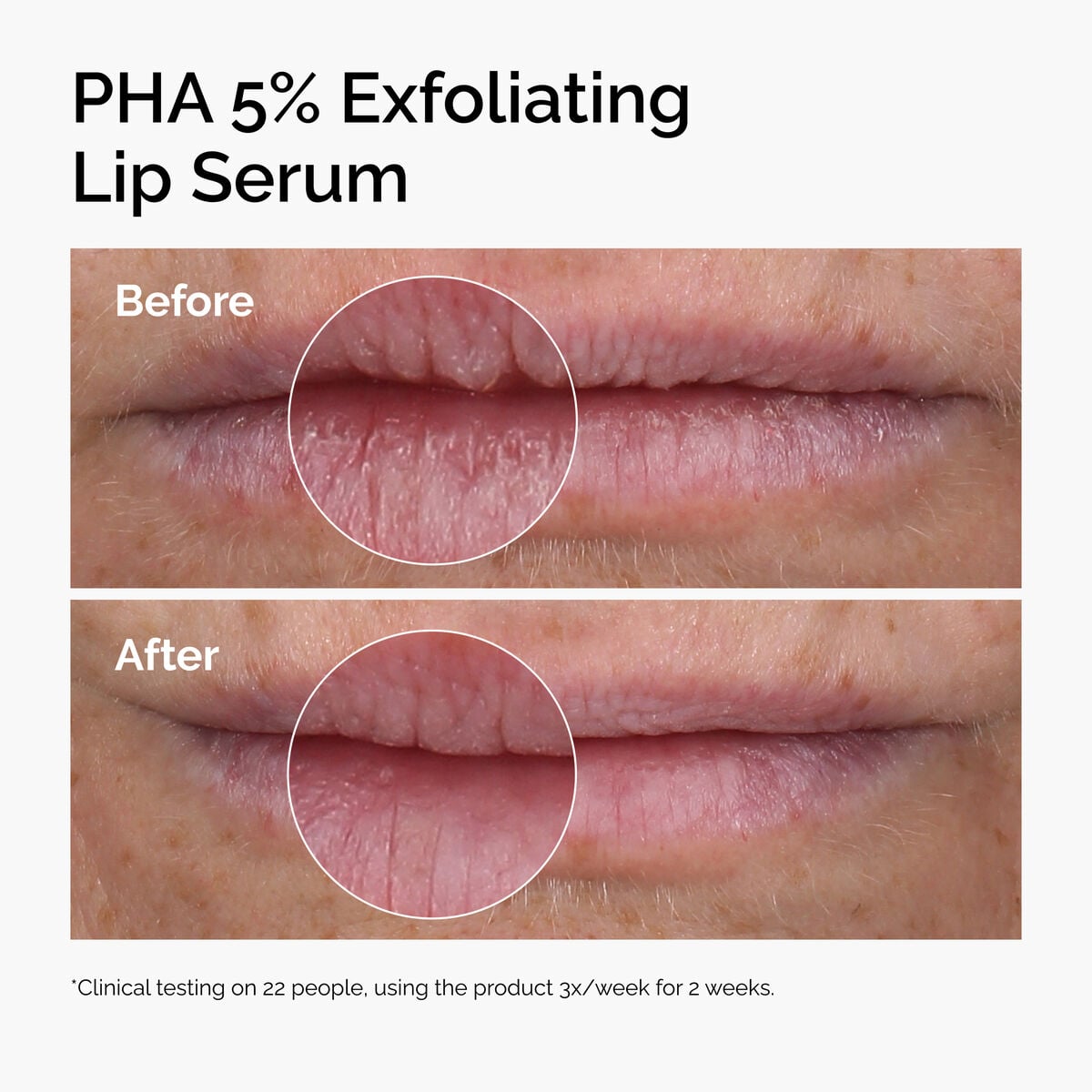 pha-5-exfoliating-lip-serum-j9 ord-pha-5pct-lip-exfoliating-serum-before-after.jpg
