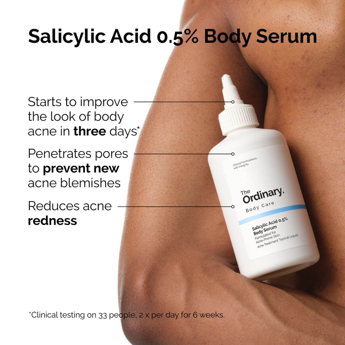 salicylic-acid-0-5-body-serum-r0 ord-salicylic-05-body-serum-otc-benefits-infographic.jpg